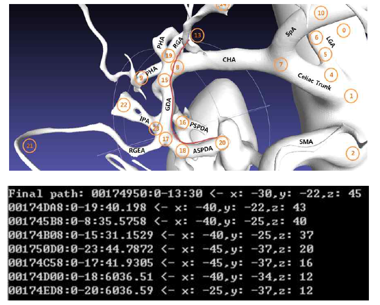 ASDPDA → RGA 구간 패스웨이