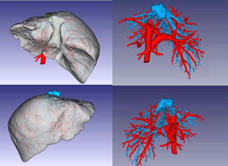 AR 콘텐츠 제작에 사용한 간·혈관 해부모델