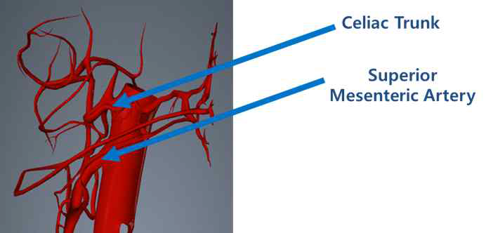동맥 혈관 대표 분기점 celiac trunk와 SMA