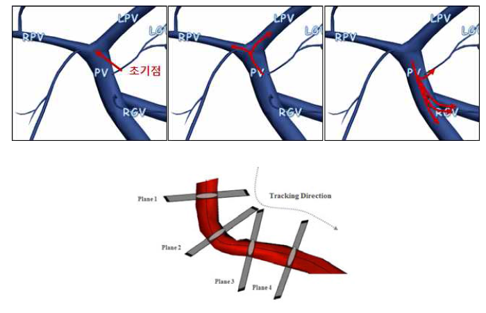능동형으로 혈관과 수직한 평면을 재구성하며 혈관을 추적해나가는 기술