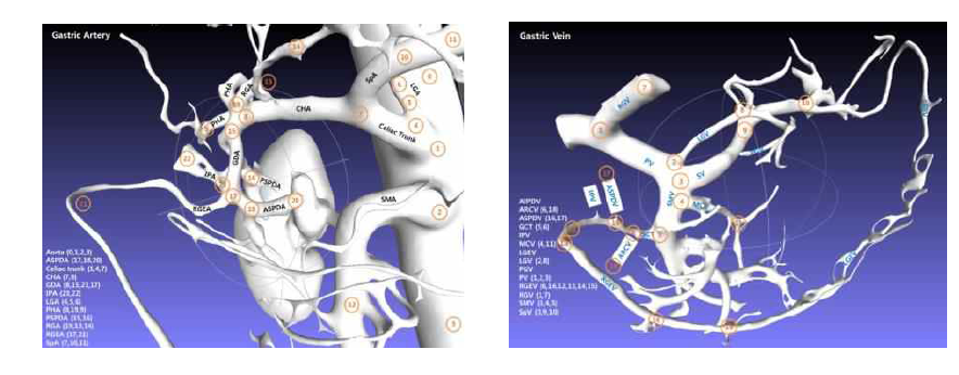 위장 근처의 동맥과 정맥 혈관 구조 예시