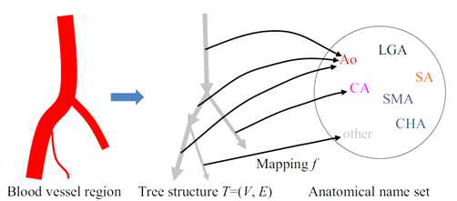 혈관 네트워크를 그래프로 매핑하는 과정