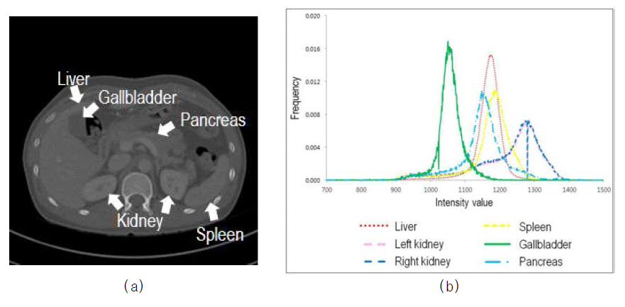 복부 CTA 영상의 특성 (a) 장기 위치, (b) 복부 장기의 밝기값 히스토그램