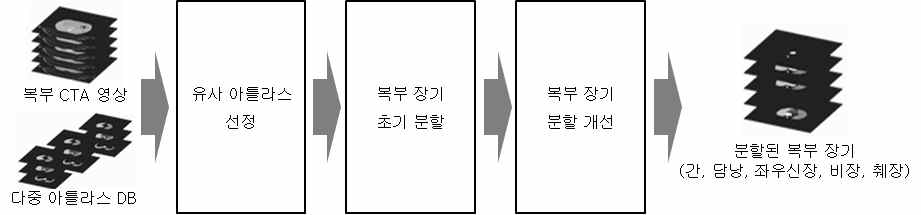 복부 영상에서 다중 아틀라스를 사용한 다기관 자동 분할 기법 순서도