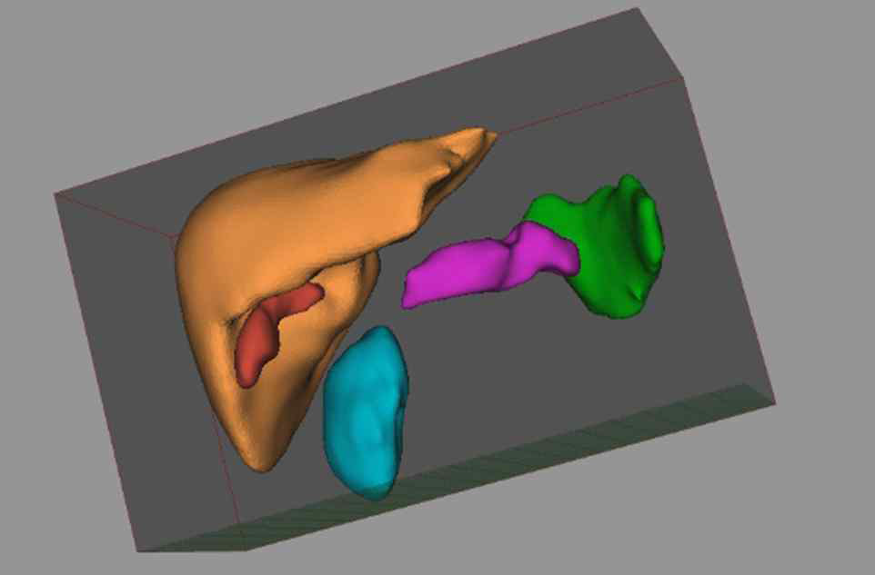 해부 모델 뷰어에서 장기 분할 결과 삼차원 가시화