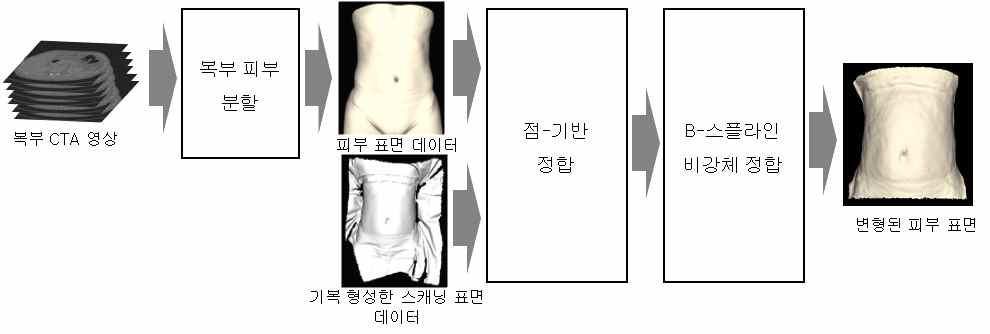 피부 분할 및 영상 정합 제안방법의 개요