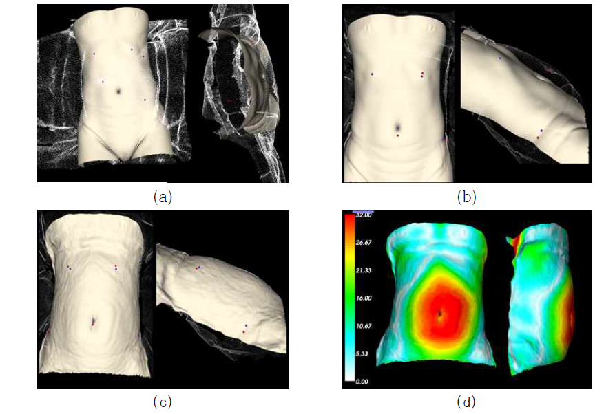 분할된 피부와 스캐닝 영상 정합 결과: (a) 점-기반 정합 전, (b) 점-기반 정합 후, (c) 변형 정합 후, (d) 변형 거리 맵