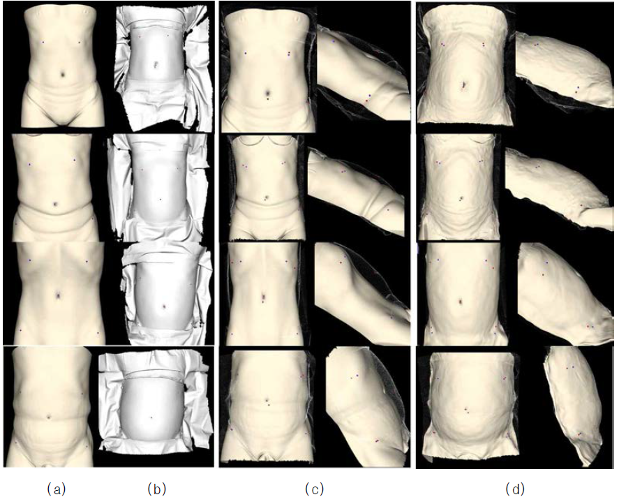 복부 CT 피부 분할 영상과 3D 스캔 영상과의 변형 정합 결과: (a) 피부 분할 결과, (b) 3D 스캔 영상, (c) 점-기반 정합 결과, (d) B-스플라인 비강체 정합 결과