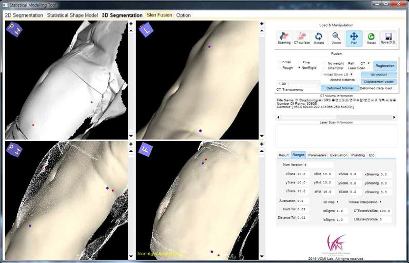 복부 CT 피부 분할 영상과 3D 스캔 영상과의 변형 정합 소프트웨어