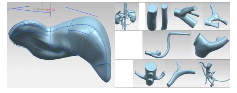 3D 프린터 출력을 위한 환자특이적 해부모델 편집