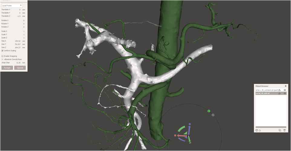 모델 편집 및 동맥·정맥 혈관 위치정합 과정
