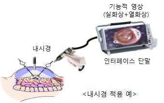 열 분포 모니터링 단말의 개요도