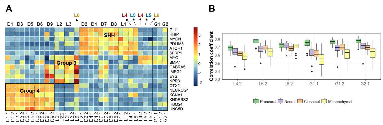 Subgroup affiliation of recurrent medulloblastoma and secondary glioblastoma based on expression profiles of subgroup-specific genes. (A) Heatmap of patient-matched primary MB-recurrent MB or secondary GBM tumor pairs based on expression profiles of subgroup-specific genes for MB. (B) Boxplots of Pearson’s correlation coefficients calculated using expression profiles of 763 GBM subtype-specific genes (Verhaak et al., 2010) between each secondary GBM sample and 163 TCGA GBM tumor samples (n = 39, 28, 42, and 54 for Proneural, Neural, Classical, and Mesenchymal subtype respectively).