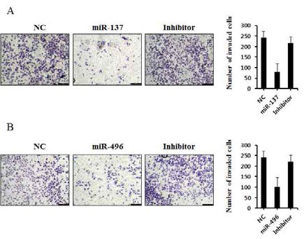 삼중음성유방암에서 miR-137과 496에 의한 세포침윤 효과