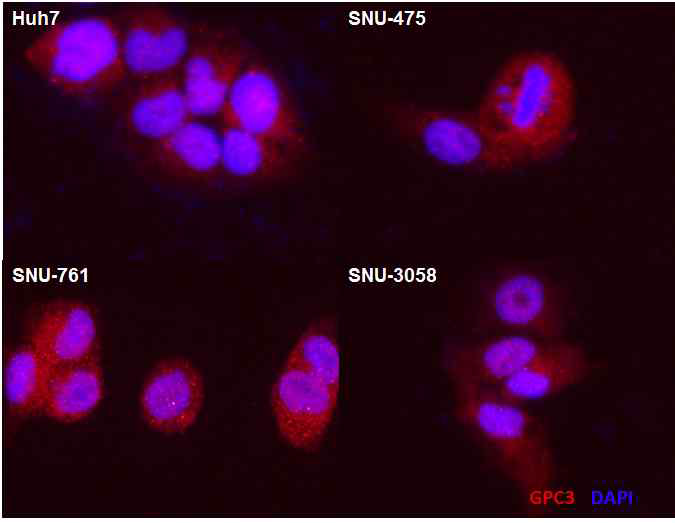 간암 세포에서의 GPC3 발현 검증