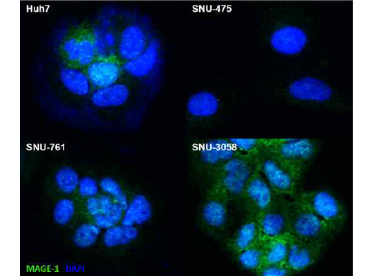 4종의 간암 세포주에서 간암 세포 표면 MAGE-1 발현 정도를 분석함