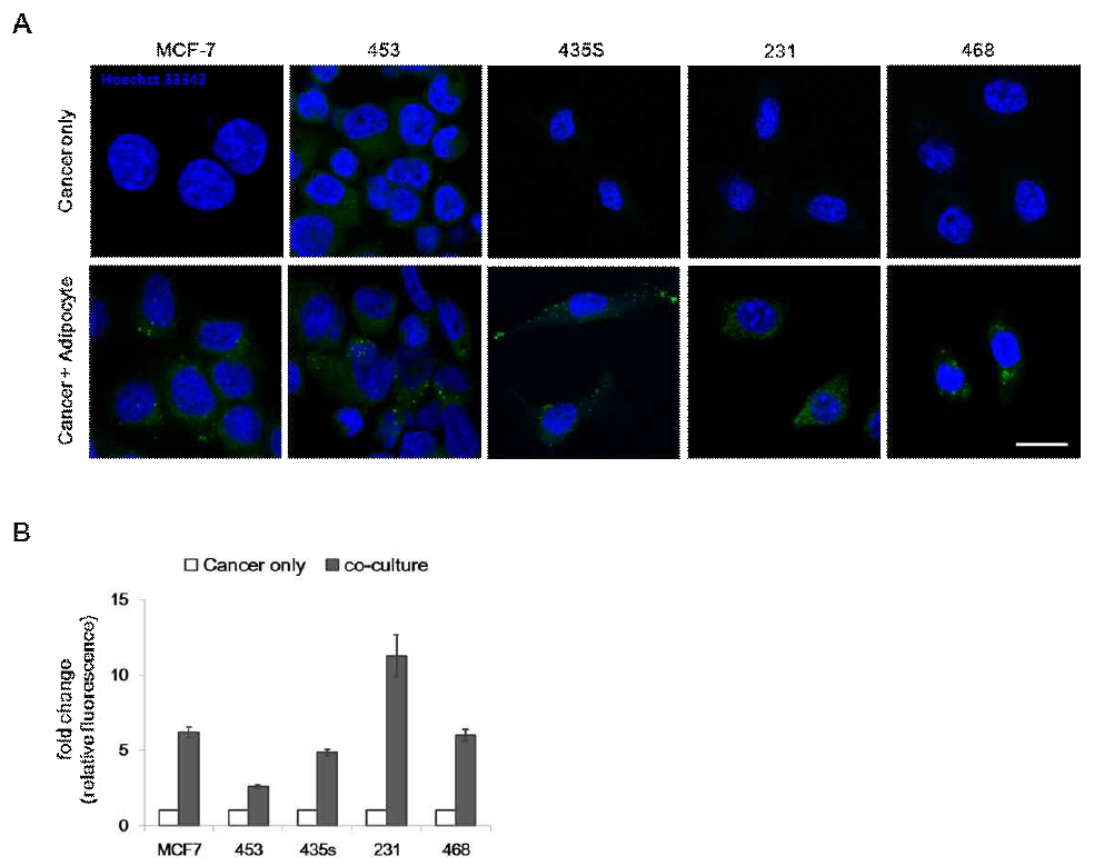 Fatty acid uptake assay.