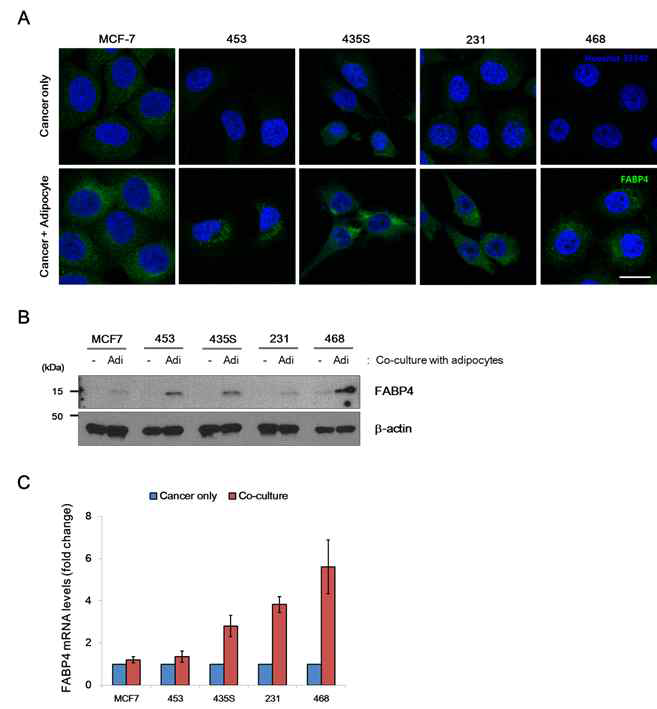 Characterization of FABP4 expression in co-cultured breast cancer cells with mature adipocytes.