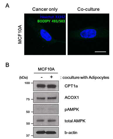 Co-culture with mature adipocytes does not affect both lipid transfer and b-oxidation in MCF10A cells