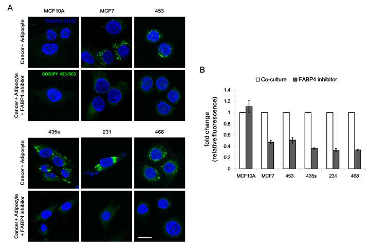 Co-culture with FABP4 inhibitor treated adipocytes reduces lipid accumulation in human breast cancer cells.