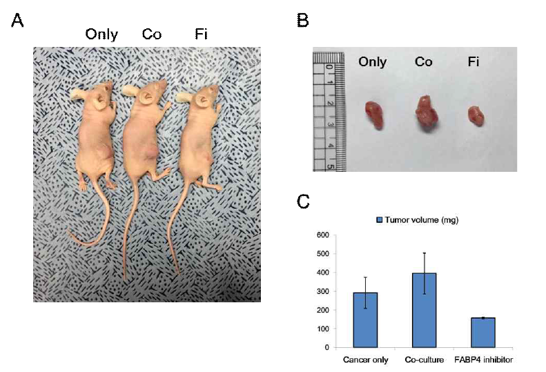 MDA-MB-231 cells co-cultured with mature adipocyte promote primary tomor growth in nude mouse model, and FABP4 plays a role in the growth of tumor