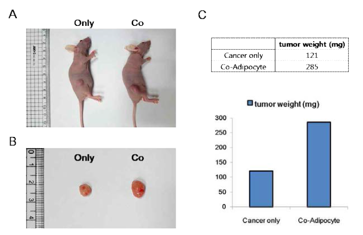 MDA-MB-468 cells co-cultured with mature adipocyte promote primary tomor growth in nude mouse model