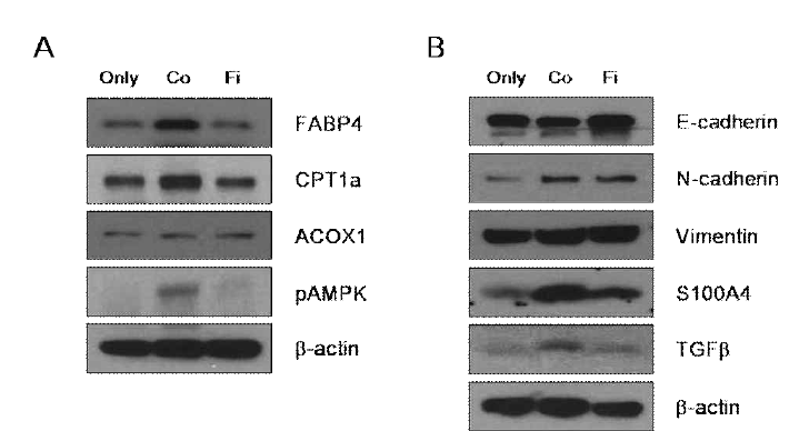 FABP4 plays a key role in β-oxidation and EMT of MDA-MB-231 co-cultured with adipocyte.