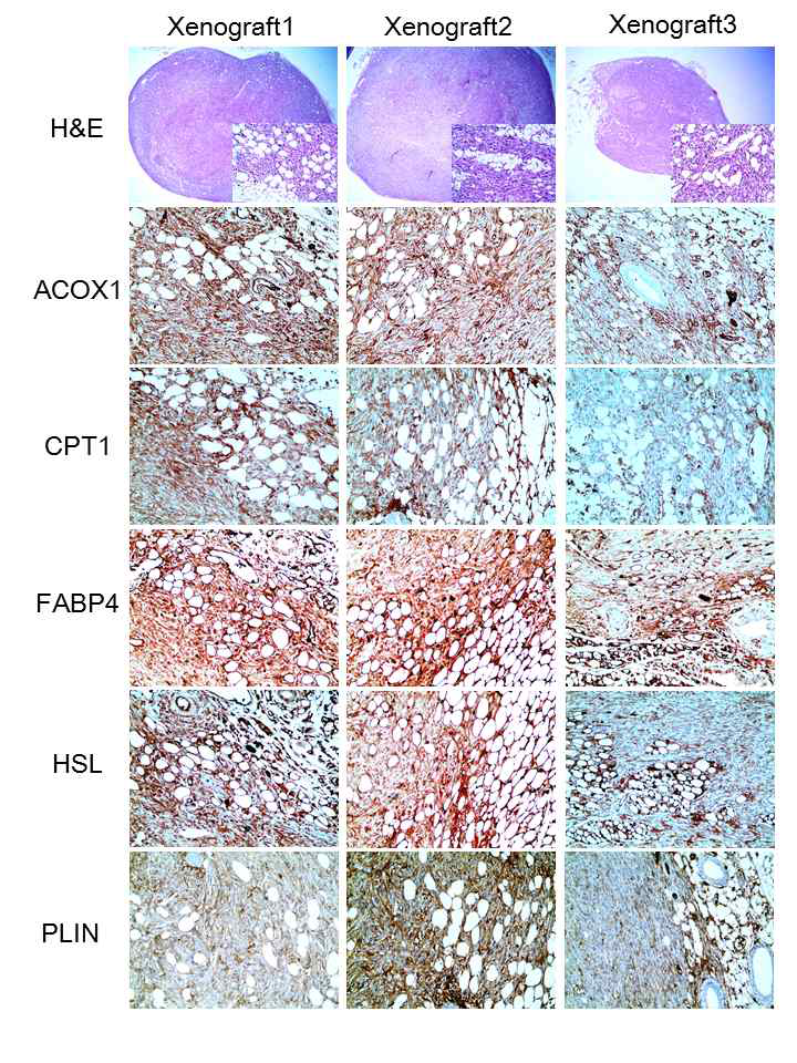 Expression of lipid metabolism related protein in mouse tumor xenograft tissue.