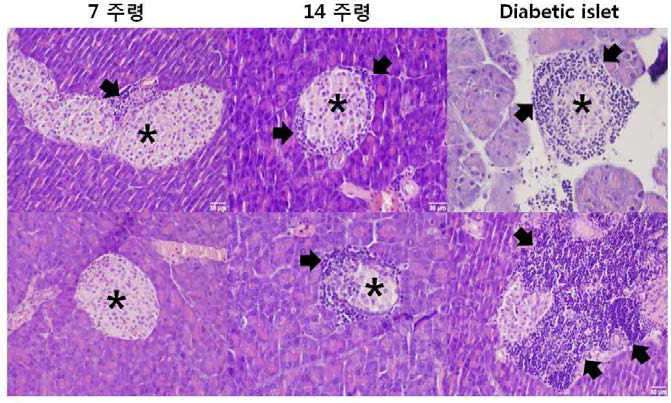 7, 14주령의 형질전환 마우스 및 고혈당 NOD 마우스의 H&E 염색 사진.