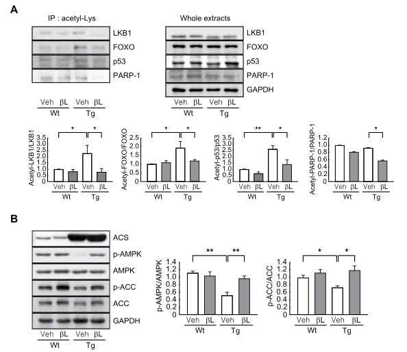 ACS유전자 과다발현 생쥐에서 β-lapachone의 Sirt1과 AMPK 활성 효과 확인