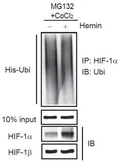 Hemin 처치가 HIF-1α 단백평형에 미치는 영향