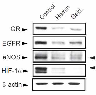 Hemin 처치에 의해 감소된 HSP90 client protein