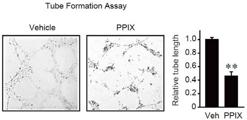 프로토포르피린 처치에 의한 내피세포의 tube formation 억제