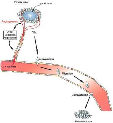 종양세포의 혈관신생과 전이