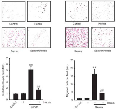 Hemin 처치에 의한 암세포의 침윤/전이 억제