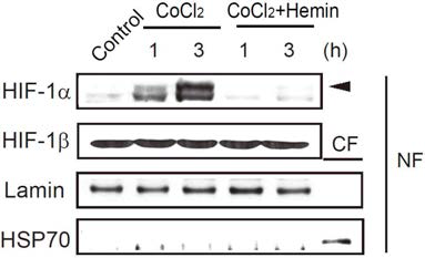 Hemin 처치에 의한 HIF-1α 핵내축적 억제