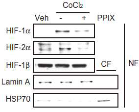 프로토포르피린 처치에 의한 HIF-1α 핵내축적 억제