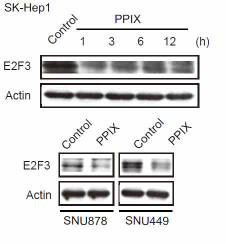 Mesenchymal 간암 세포주에서 프로토포르피린에 의한 E2F3 억제