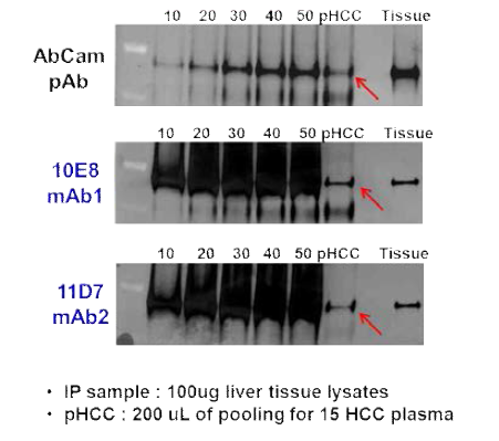 임상 시료에서 hCE1-antibody clone의 반응성 연구