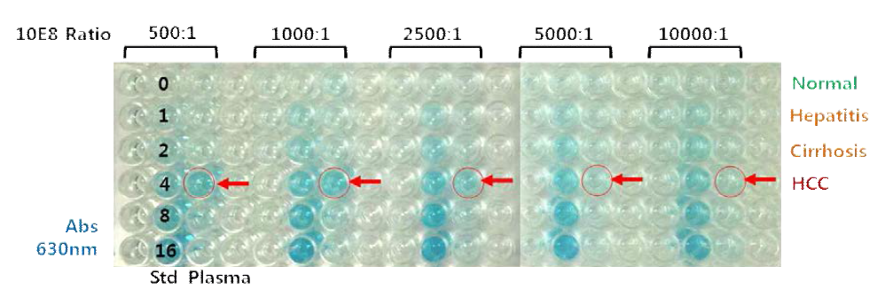 1차 항체 첨가비율에 따른 질환 plasma hCE1 분석 패턴