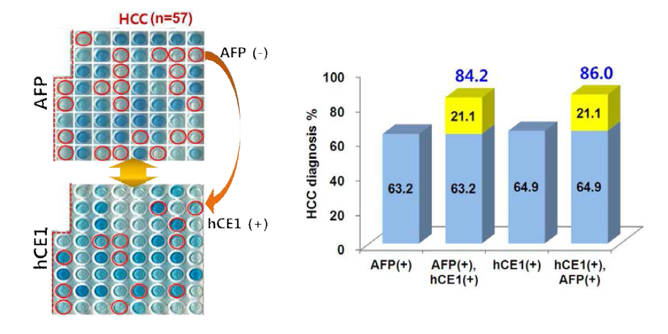 AFP, hCE1 및 혼용 시 간암 진단율