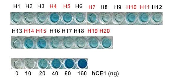 hCE1 ELISA 분석을 통한 간암 진단 (cutoff=20 ng/mL)