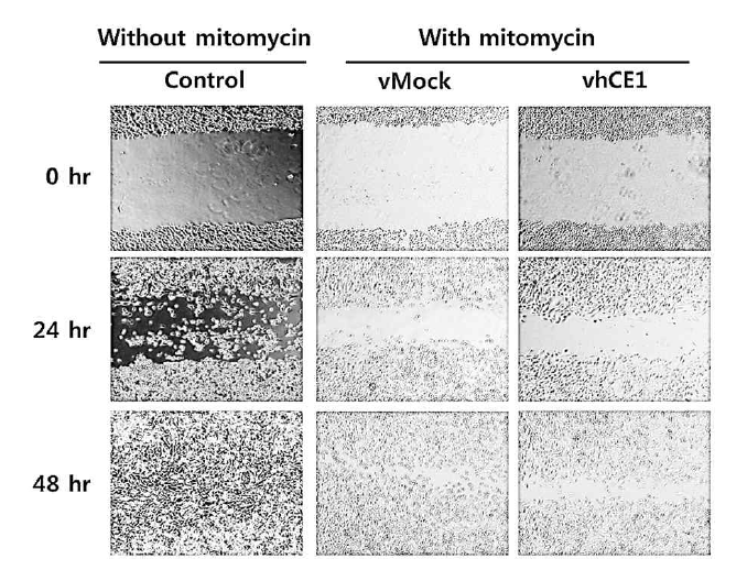 hCE1의 과발현에 의한 metastatic activity