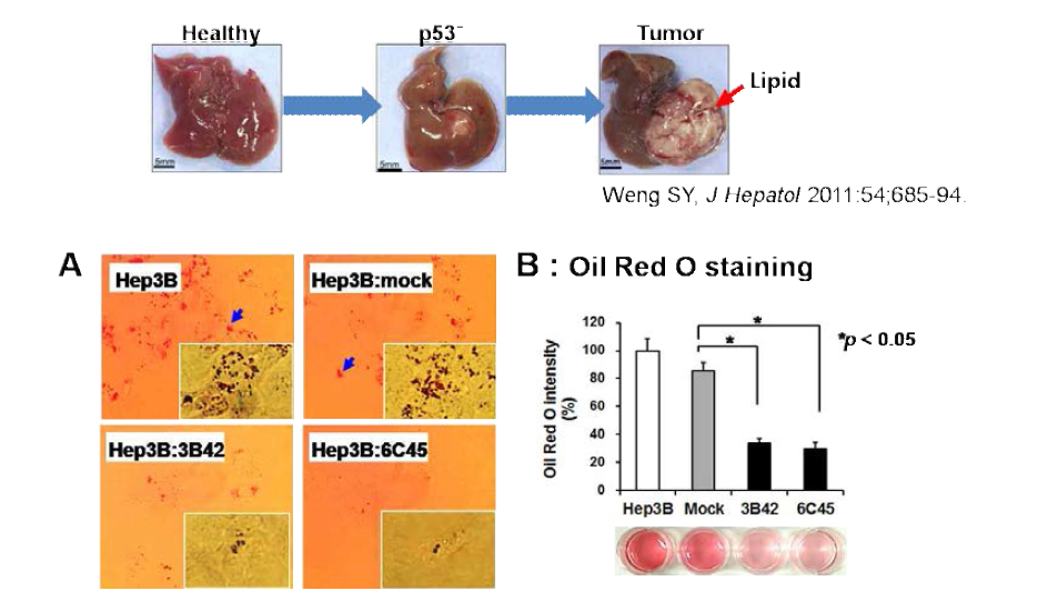 간암세포 Hep3B에 hCE1 과발현시 lipid accumulation 측정