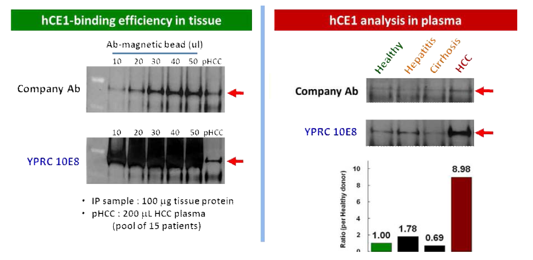 간조직 및 혈액에서 YPRC 10E8 단일항체의 hCE1 결합 효율성