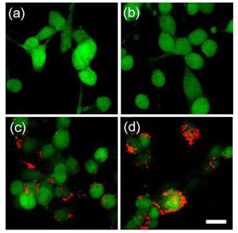 ZnPc(적색)가 탑재된 플라즈몬성 리포좀을 다양한 나노입자 농도로 암세포(녹색)에 처리한 후 얻은 공초점 형광현미경 사진