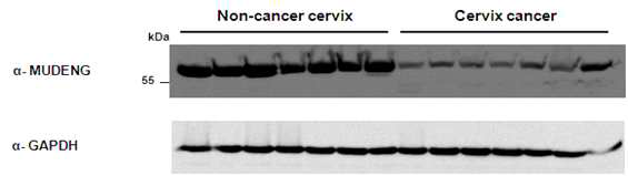 자궁경부암 조직에서 MUDENG의 발현