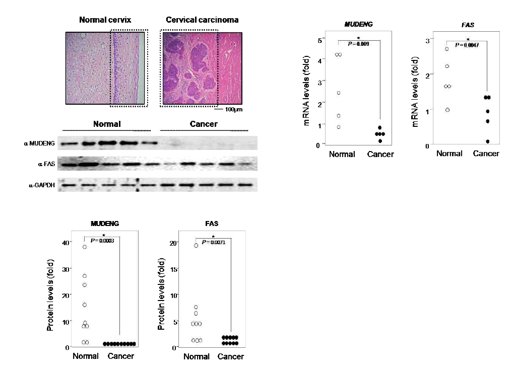 자궁경부암 환자에서 MUDENG과 FAS의 mRNA 발현변화