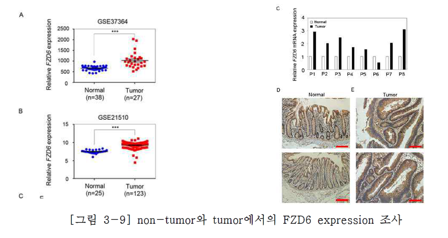 non-tumor와 tumor에서의 FZD6 expression 조사