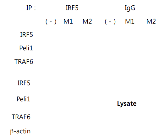 Pellino1과 IRF5의 결합을 생체 유래 세포에서 확인